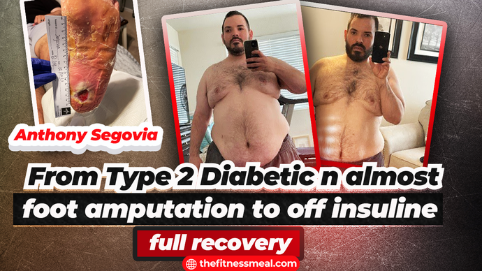 Desperate: Anthony's Diabetes Crisis - Almost Losing His Feet😮